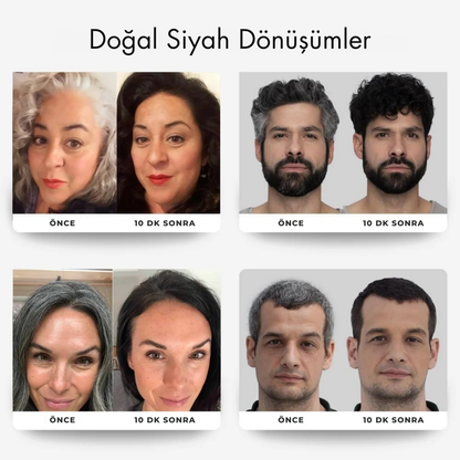 Beyaz Kapatıcı Pigment Saç Şampuanı