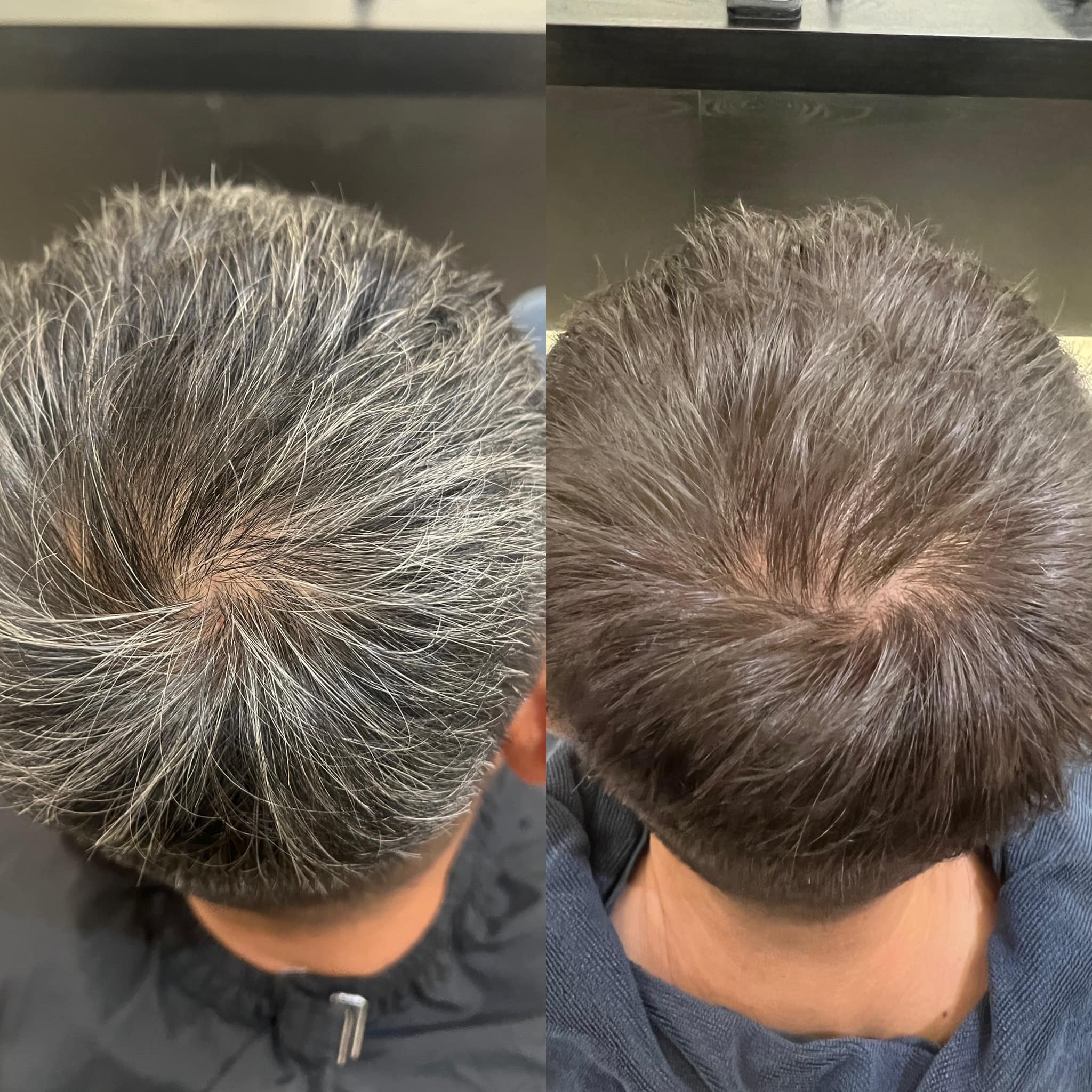 OneColor önce/sonra - erkek kullanıcı 3