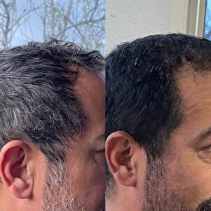 OneColor önce/sonra - erkek kullanıcı 2